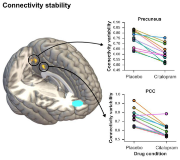 Results from an MEG study, showing activity in the medial temporal lobe